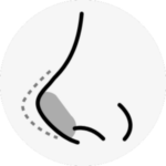 rhinoplasty in korea the plus plastic surgery gangnam