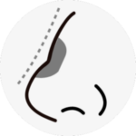 rhinoplasty in korea the plus plastic surgery gangnam