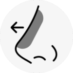 rhinoplasty in korea the plus plastic surgery gangnam