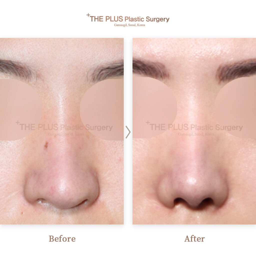 THE PLUS CLINIC KOREA -