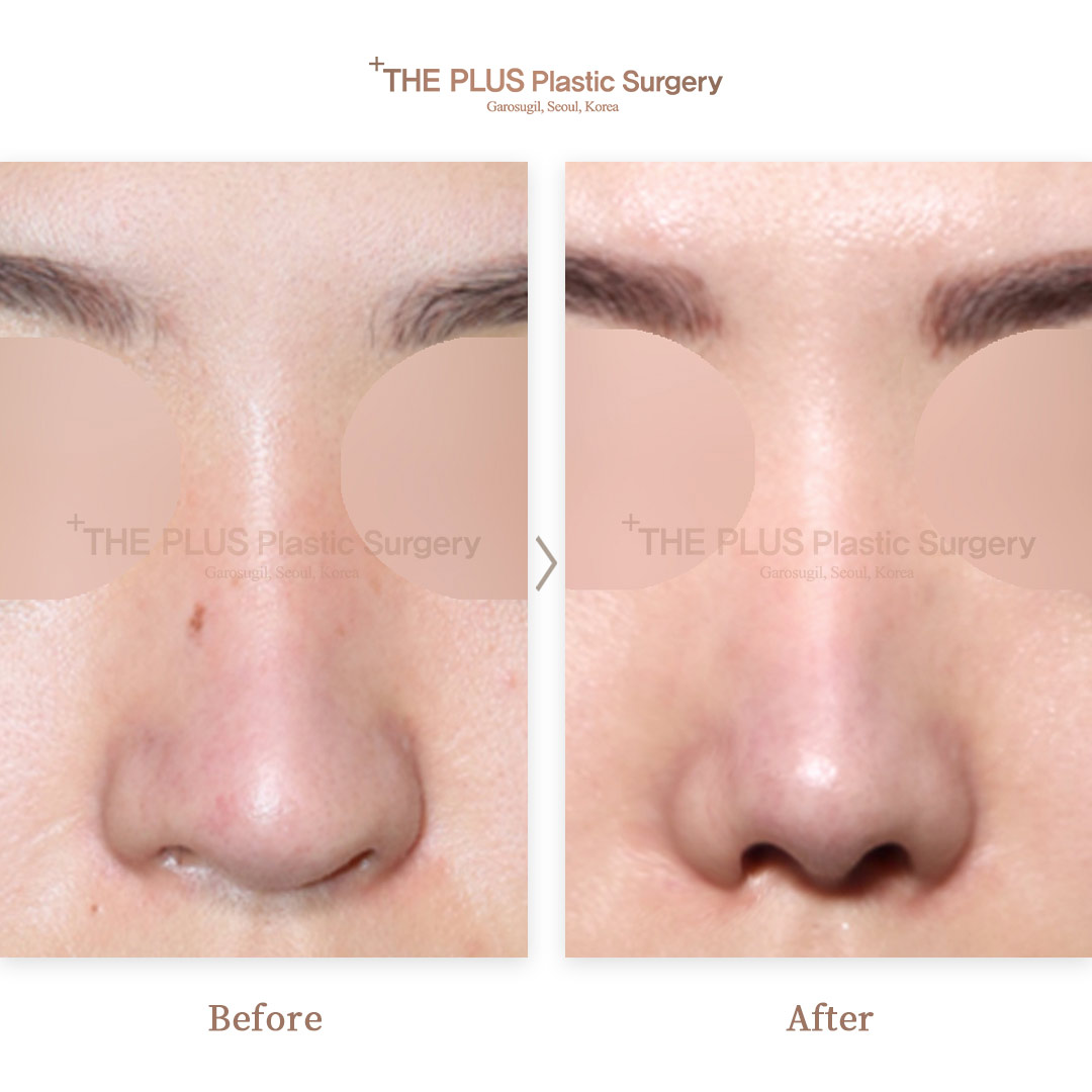 THE PLUS CLINIC KOREA -