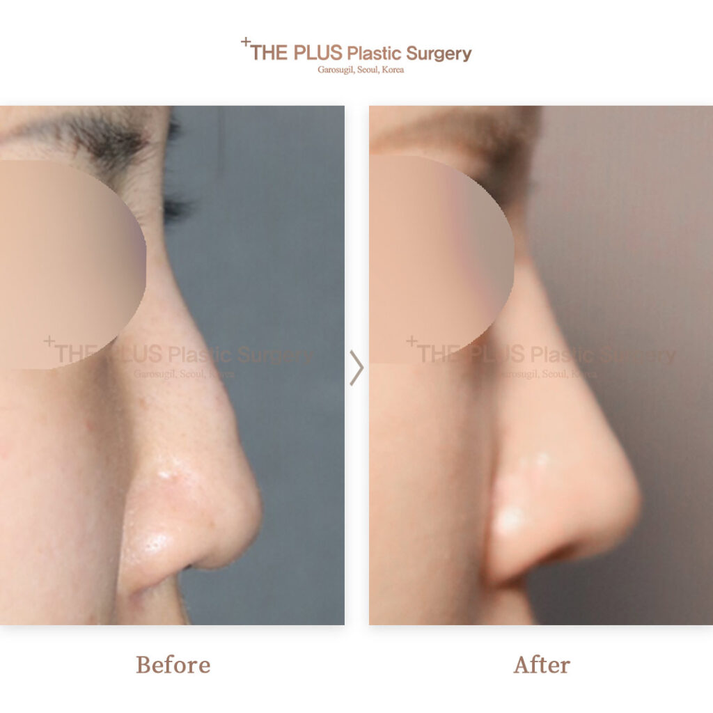 THE PLUS CLINIC KOREA -
