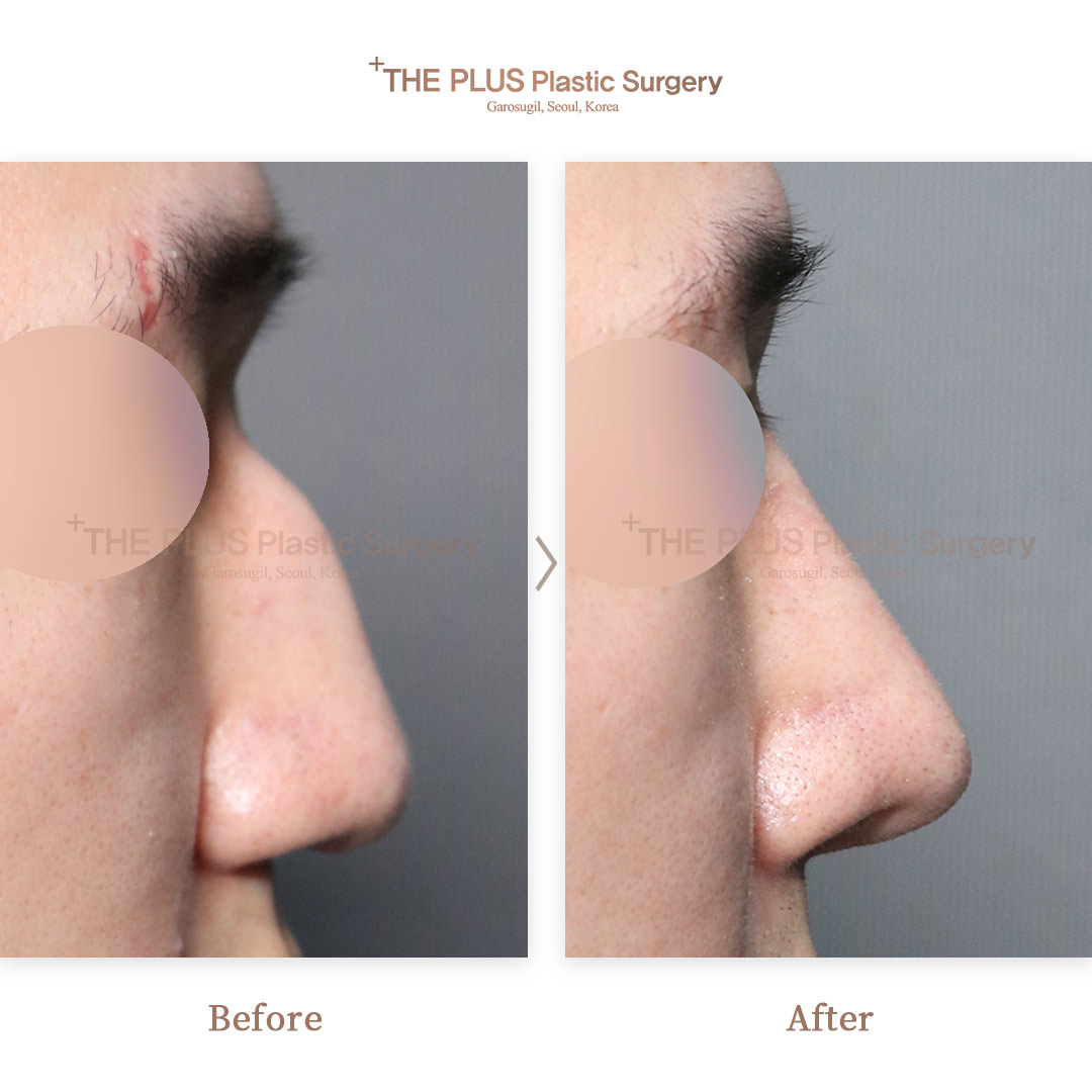 THE PLUS CLINIC KOREA -