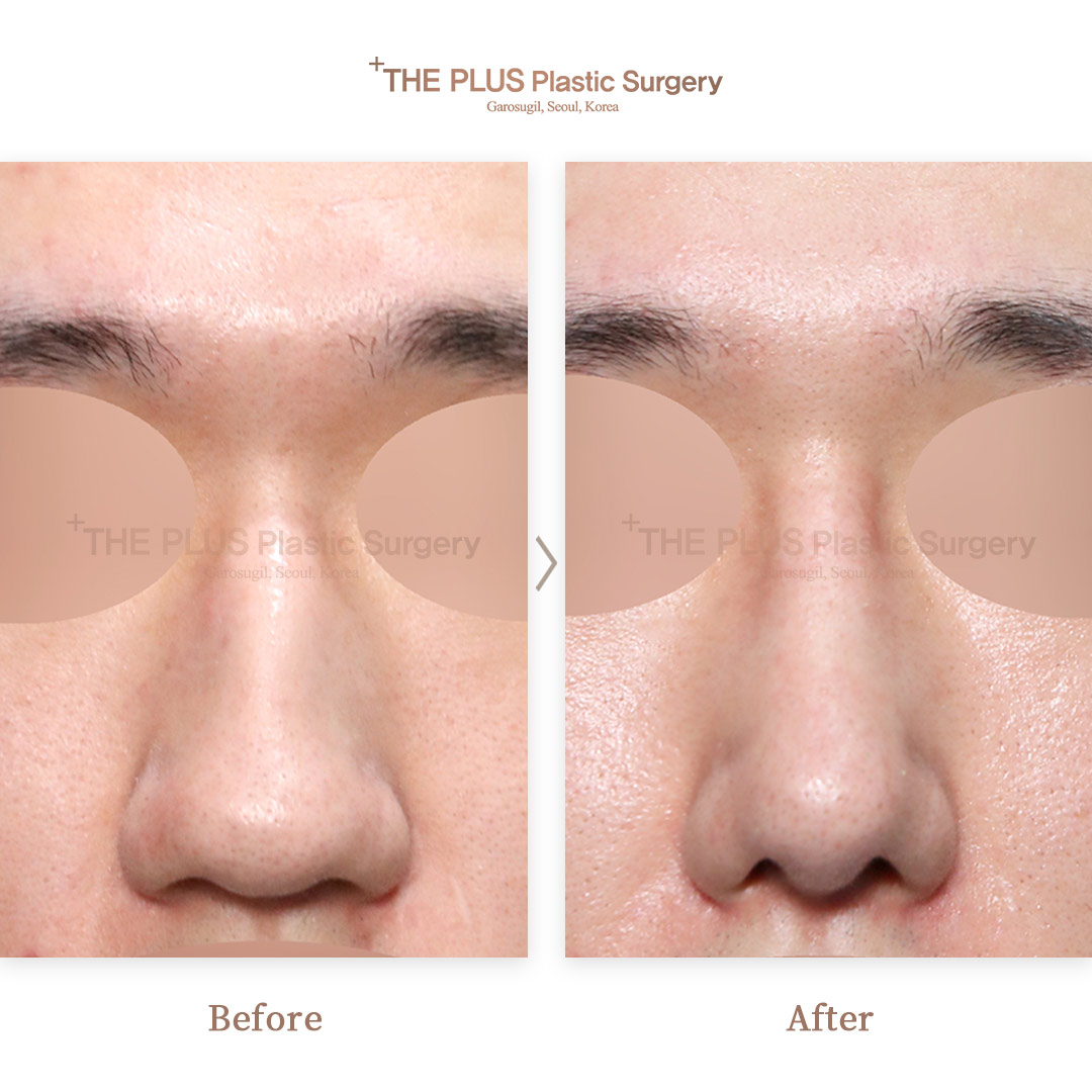 THE PLUS CLINIC KOREA -