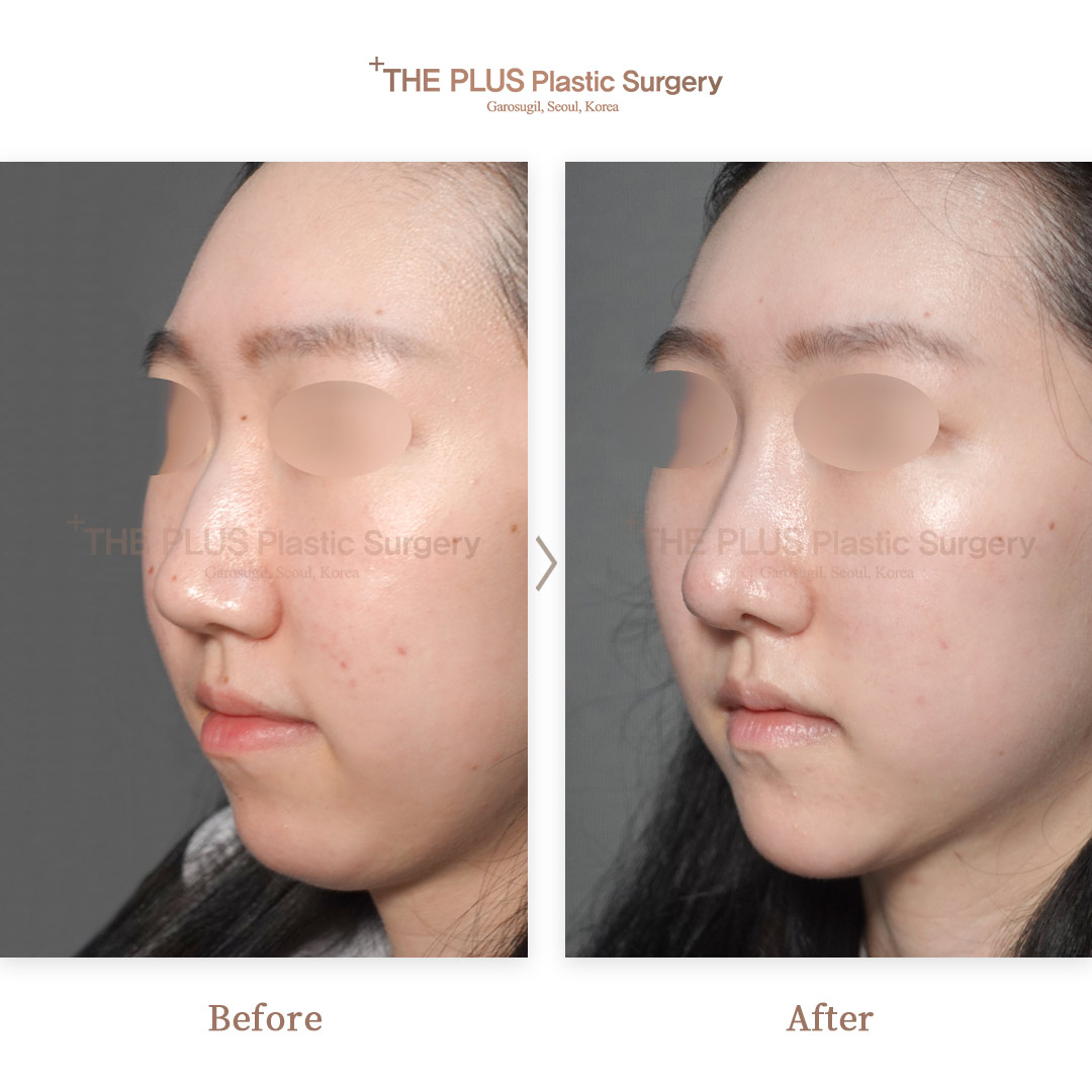 THE PLUS CLINIC KOREA -