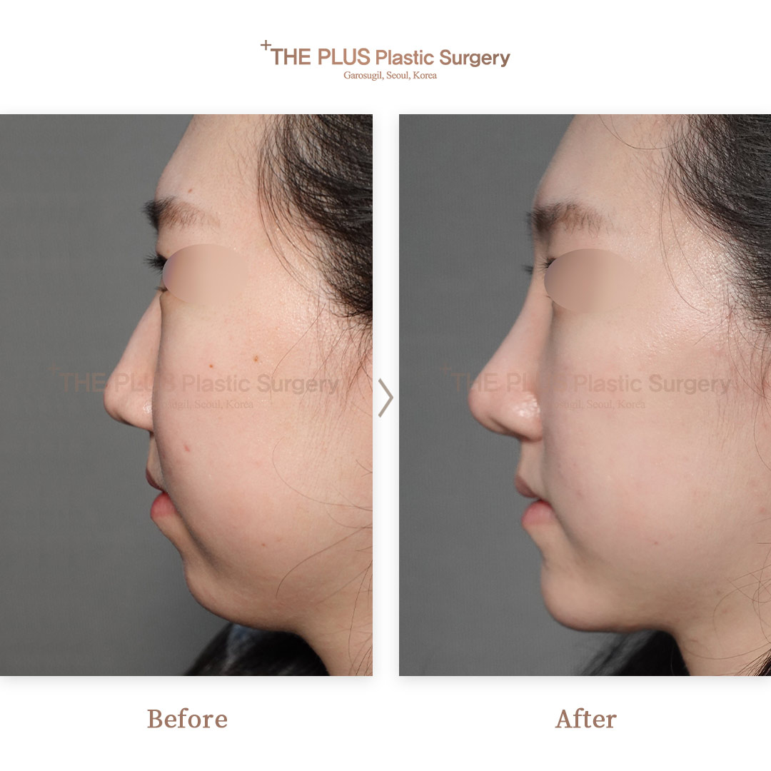 THE PLUS CLINIC KOREA -