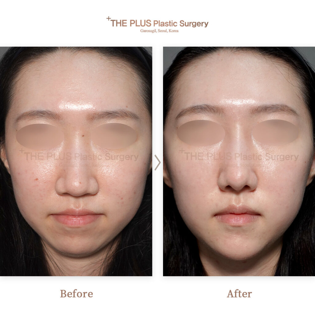 THE PLUS CLINIC KOREA -
