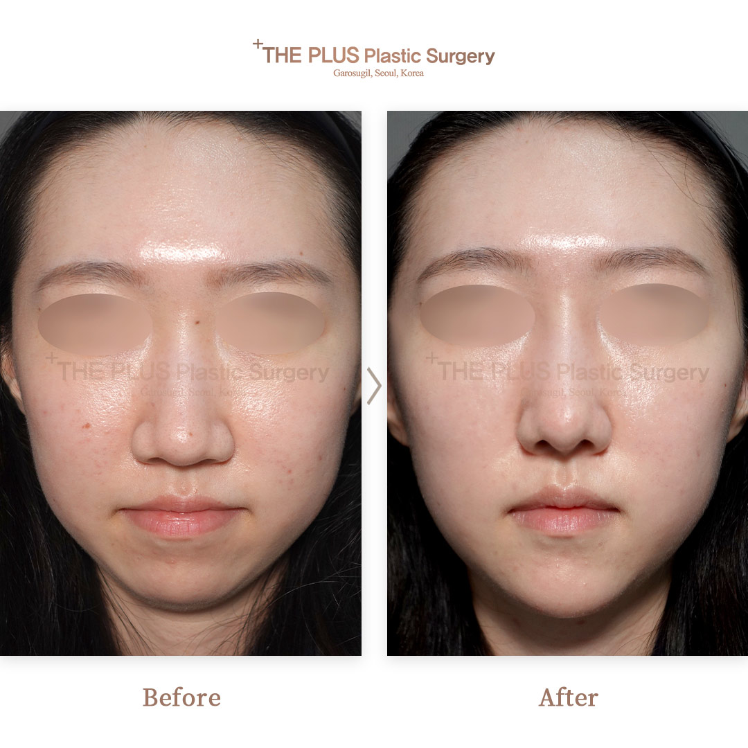 THE PLUS CLINIC KOREA -