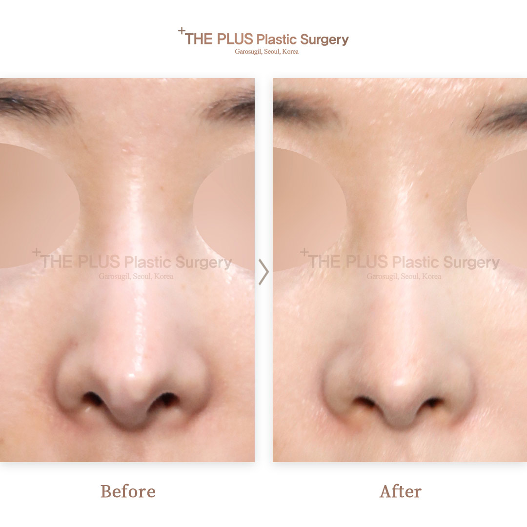 THE PLUS CLINIC KOREA -