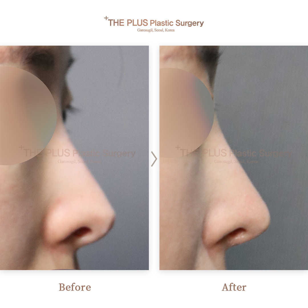 THE PLUS CLINIC KOREA -