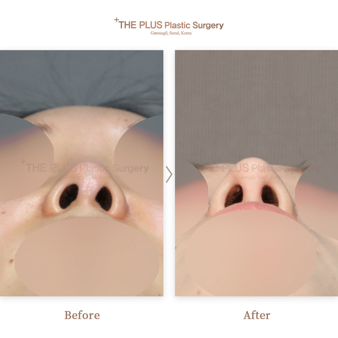THE PLUS CLINIC KOREA -