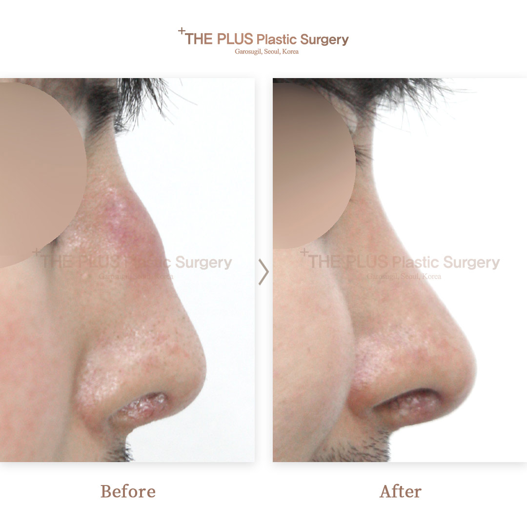 THE PLUS CLINIC KOREA -