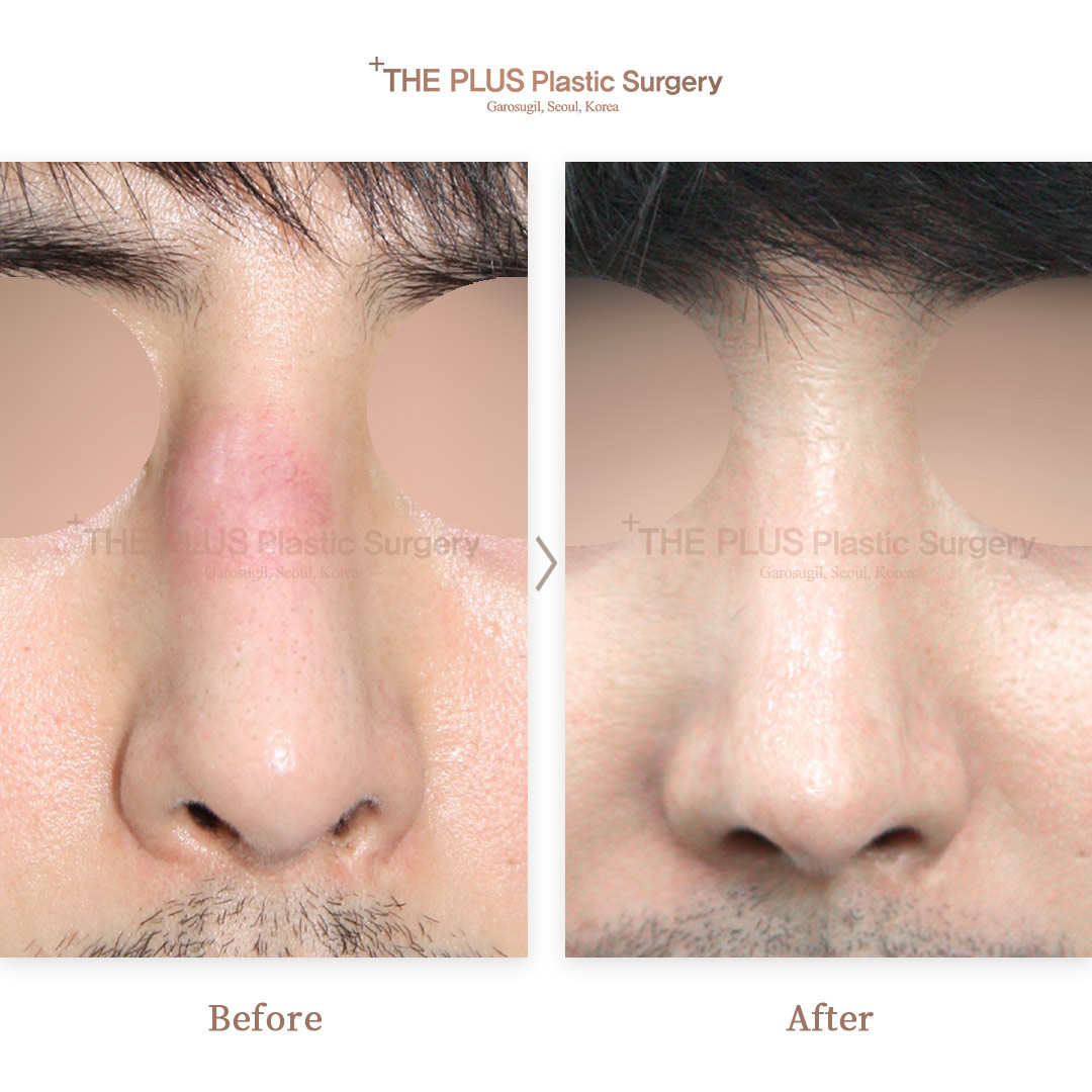 THE PLUS CLINIC KOREA -