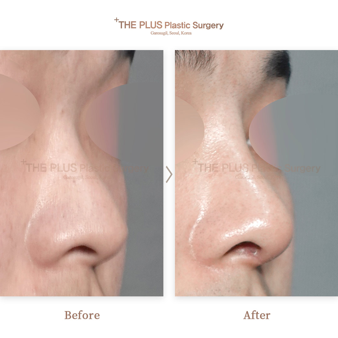 THE PLUS CLINIC KOREA -