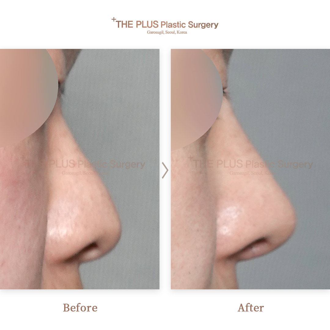 THE PLUS CLINIC KOREA -