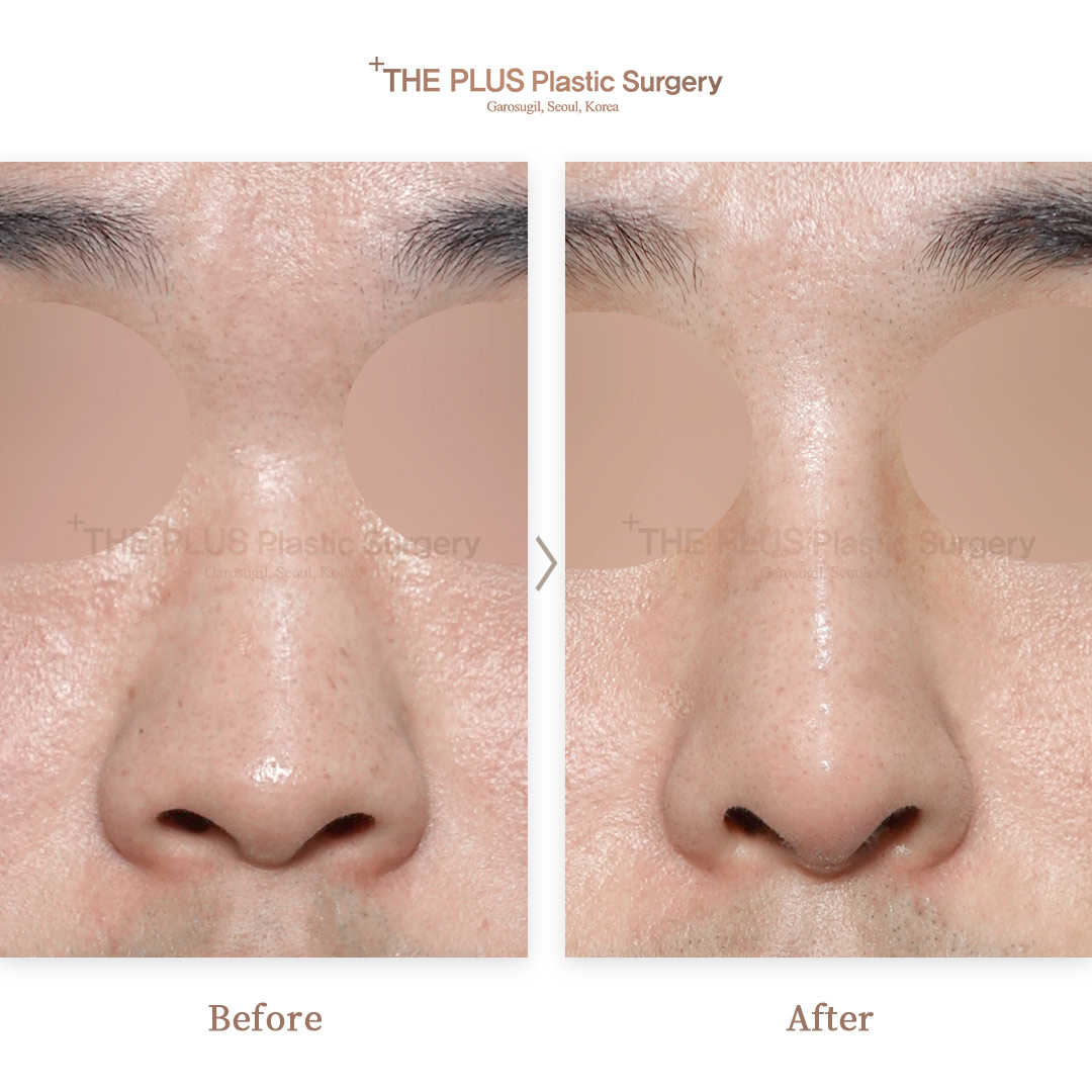 THE PLUS CLINIC KOREA -