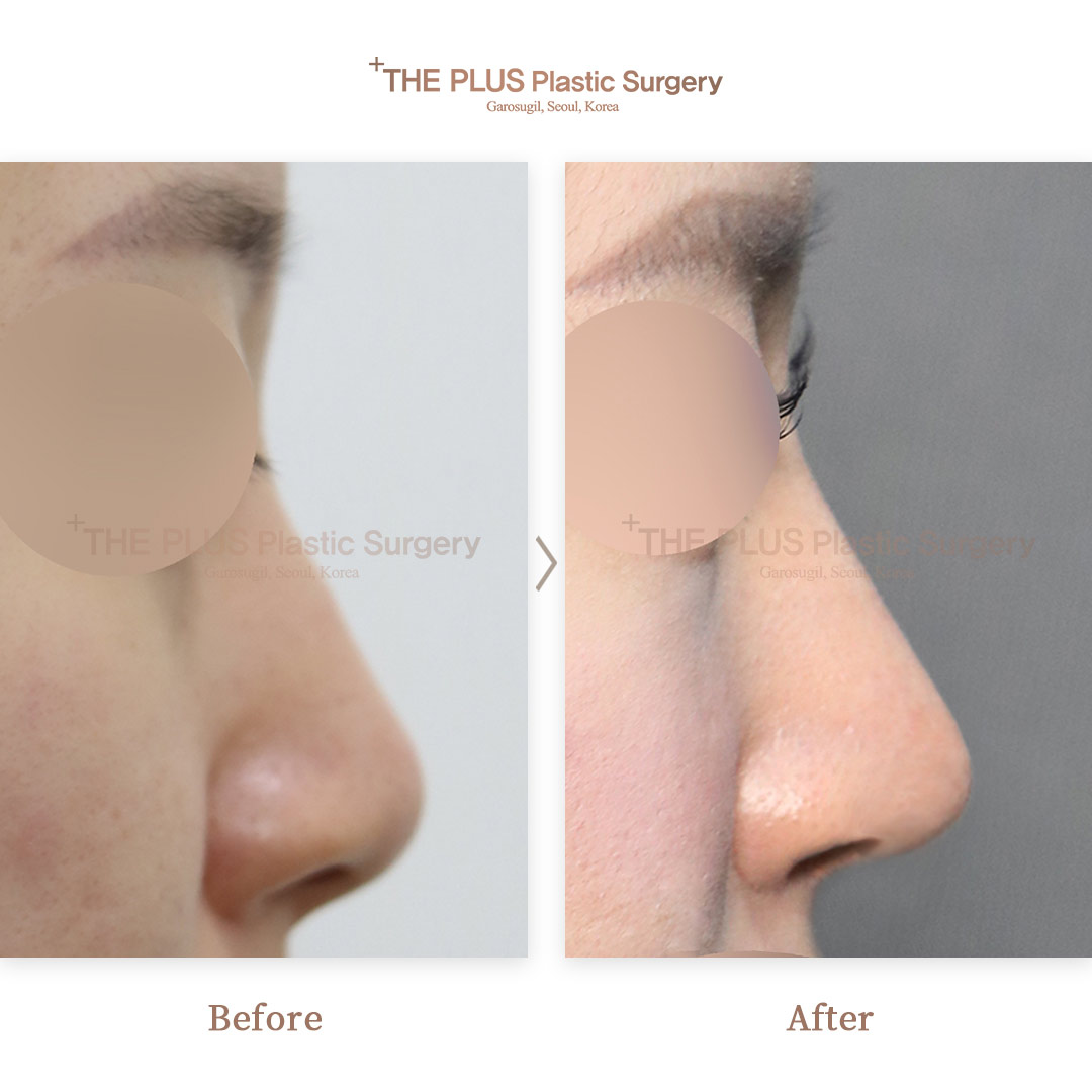 THE PLUS CLINIC KOREA -