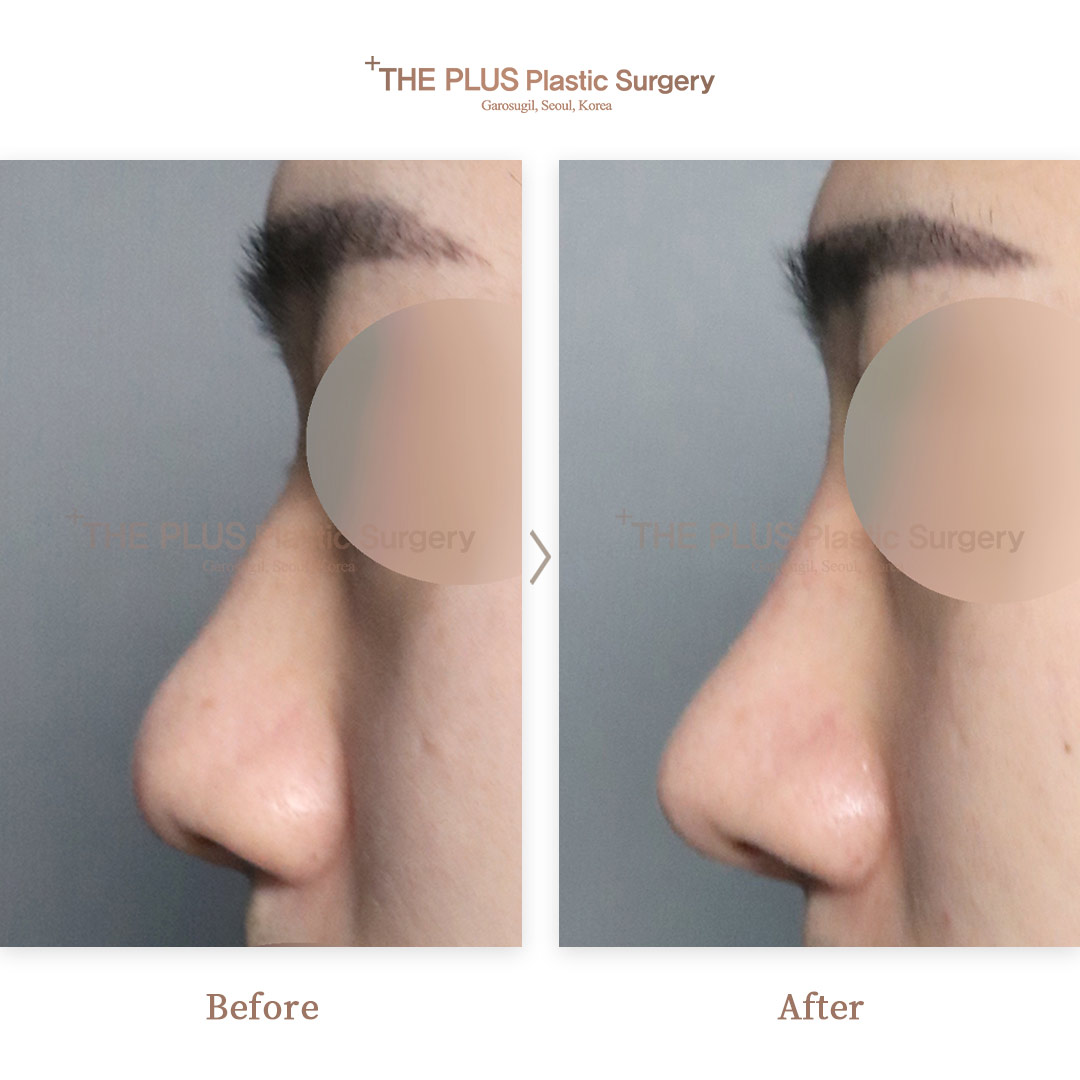 THE PLUS CLINIC KOREA -