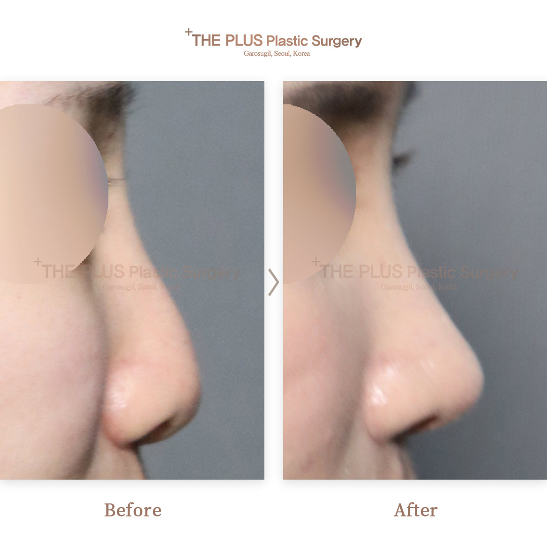 THE PLUS CLINIC KOREA -