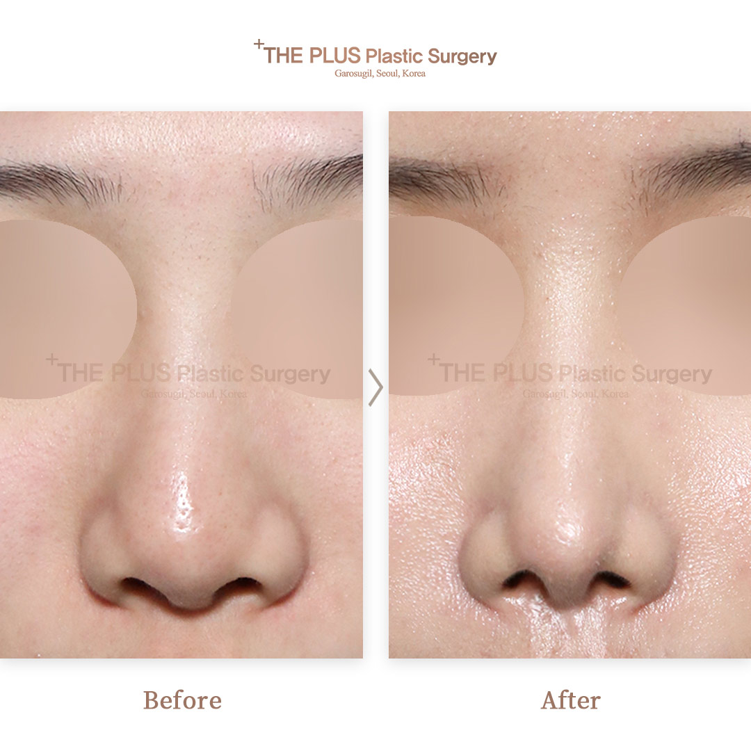 THE PLUS CLINIC KOREA -
