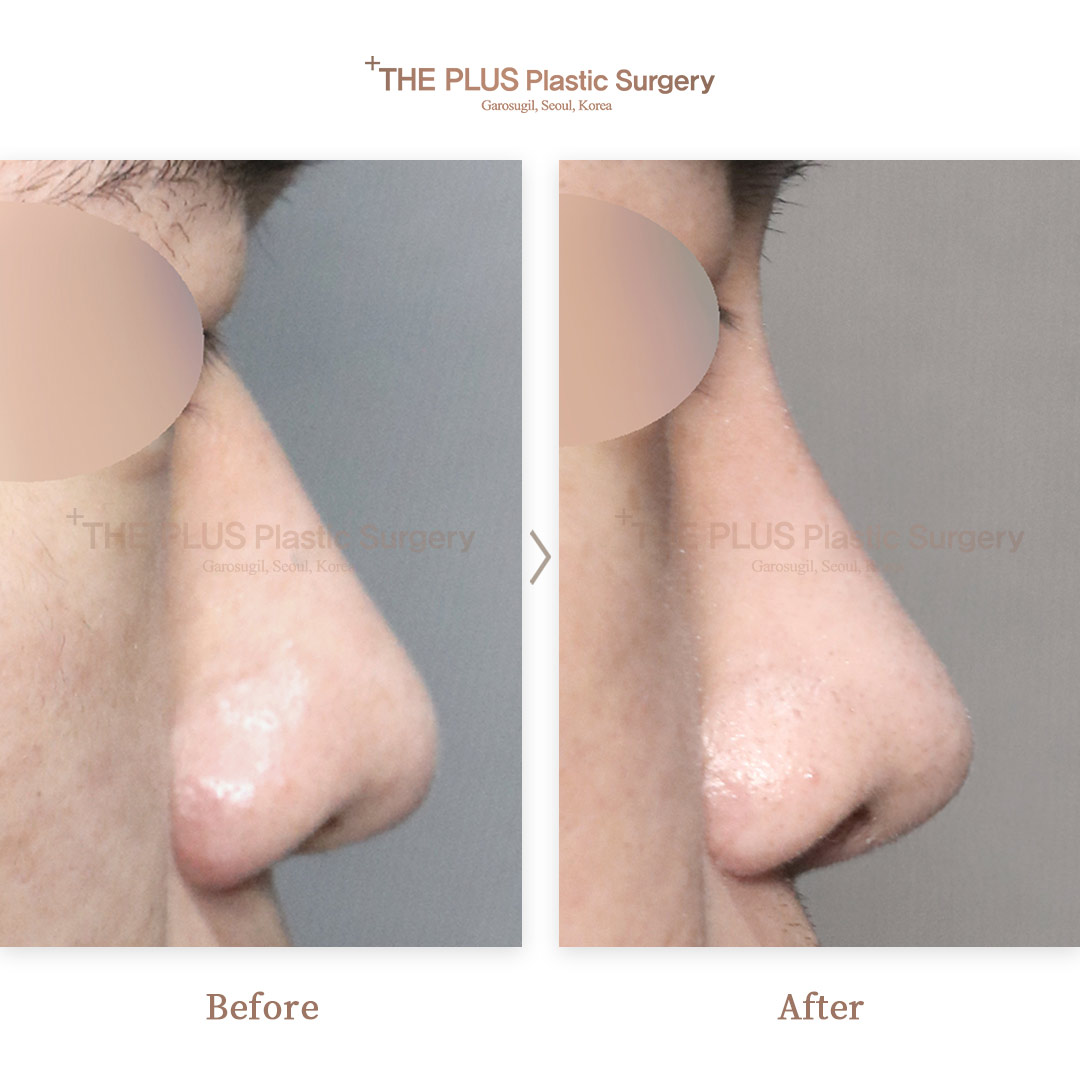 THE PLUS CLINIC KOREA -