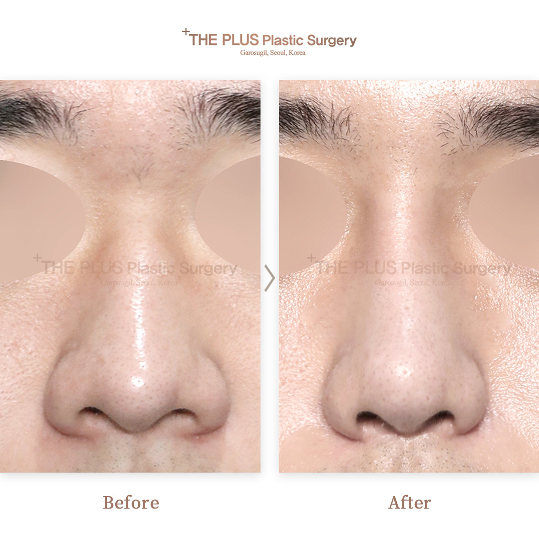 THE PLUS CLINIC KOREA -