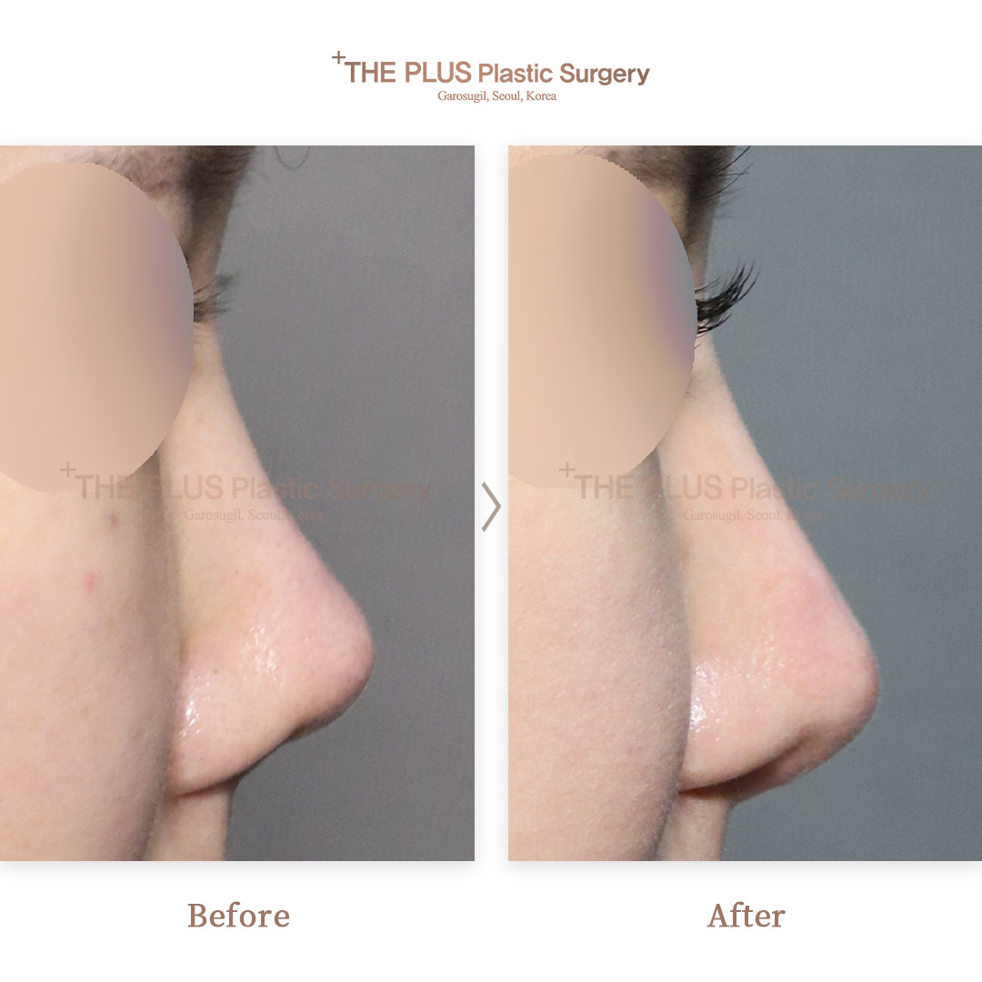 THE PLUS CLINIC KOREA -