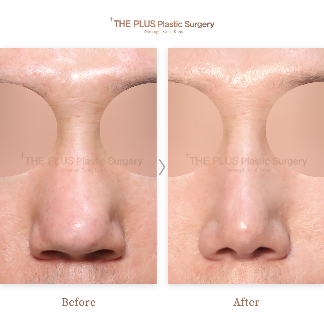 THE PLUS CLINIC KOREA -