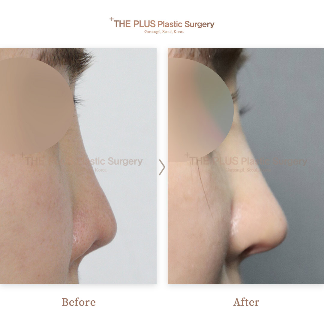 THE PLUS CLINIC KOREA -