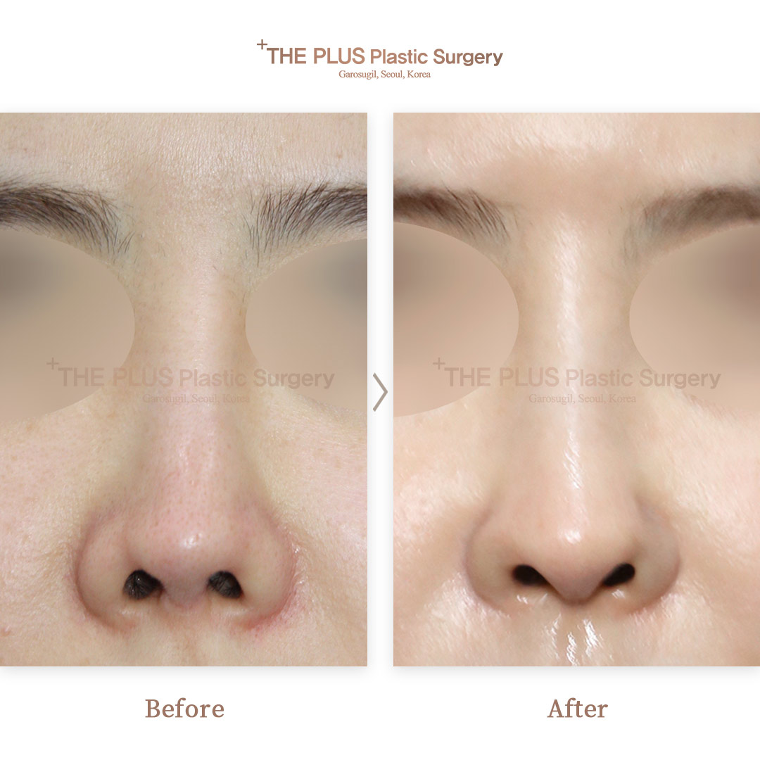 THE PLUS CLINIC KOREA -