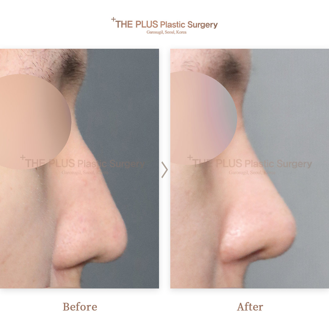 THE PLUS CLINIC KOREA -