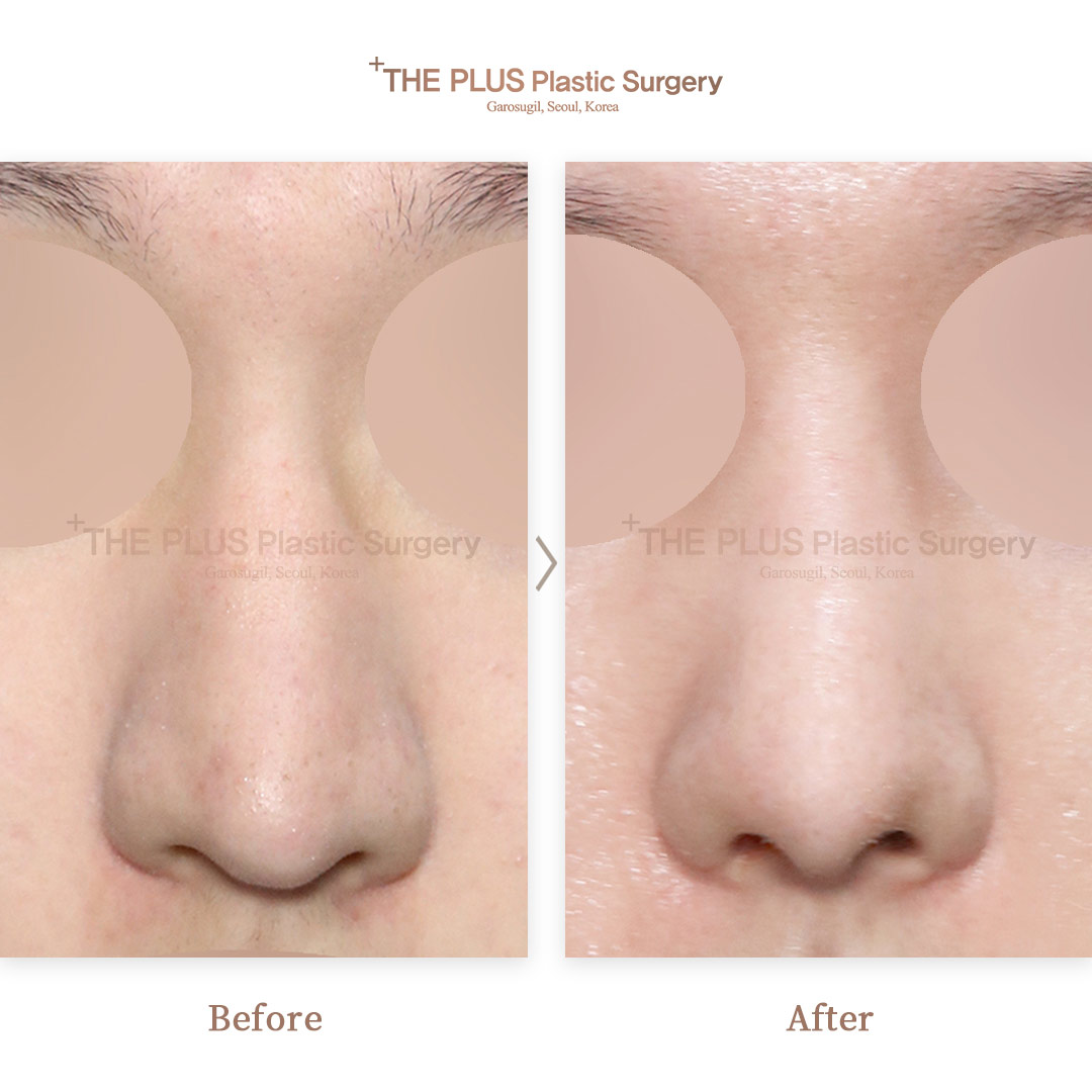 THE PLUS CLINIC KOREA -