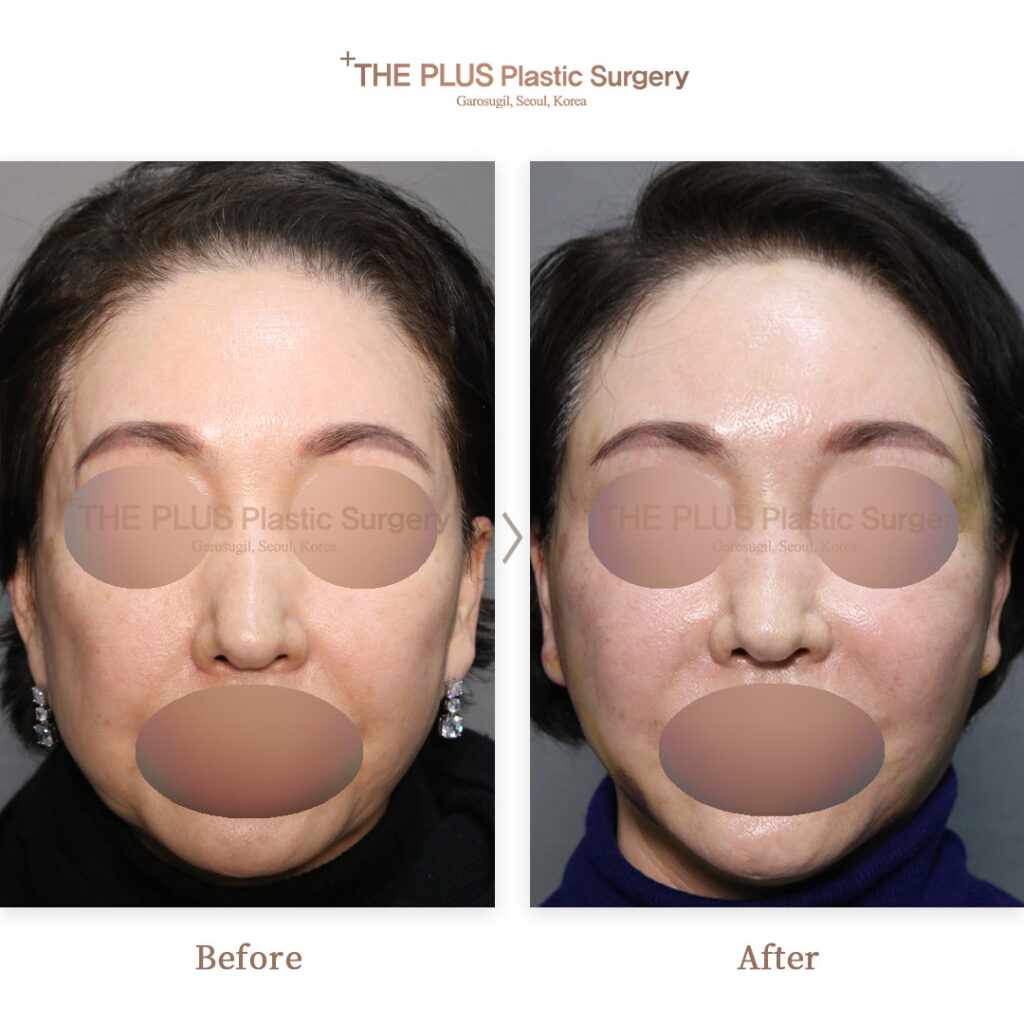 THE PLUS CLINIC KOREA -