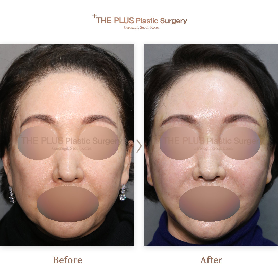 THE PLUS CLINIC KOREA -