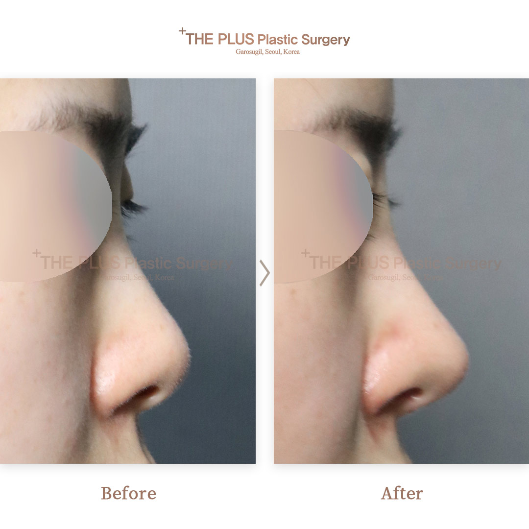 THE PLUS CLINIC KOREA -