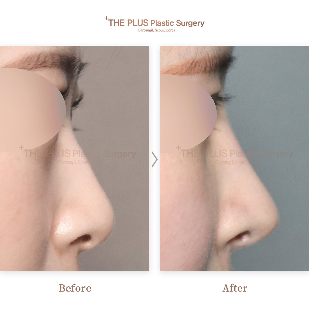 THE PLUS CLINIC KOREA -