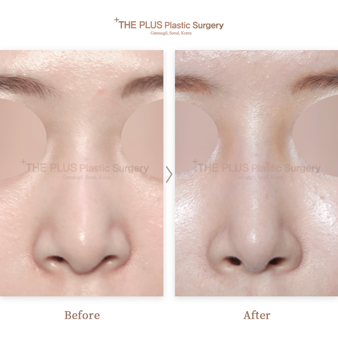 THE PLUS CLINIC KOREA -