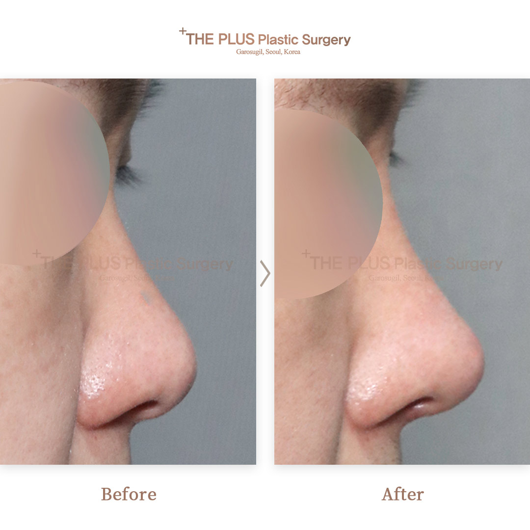THE PLUS CLINIC KOREA -