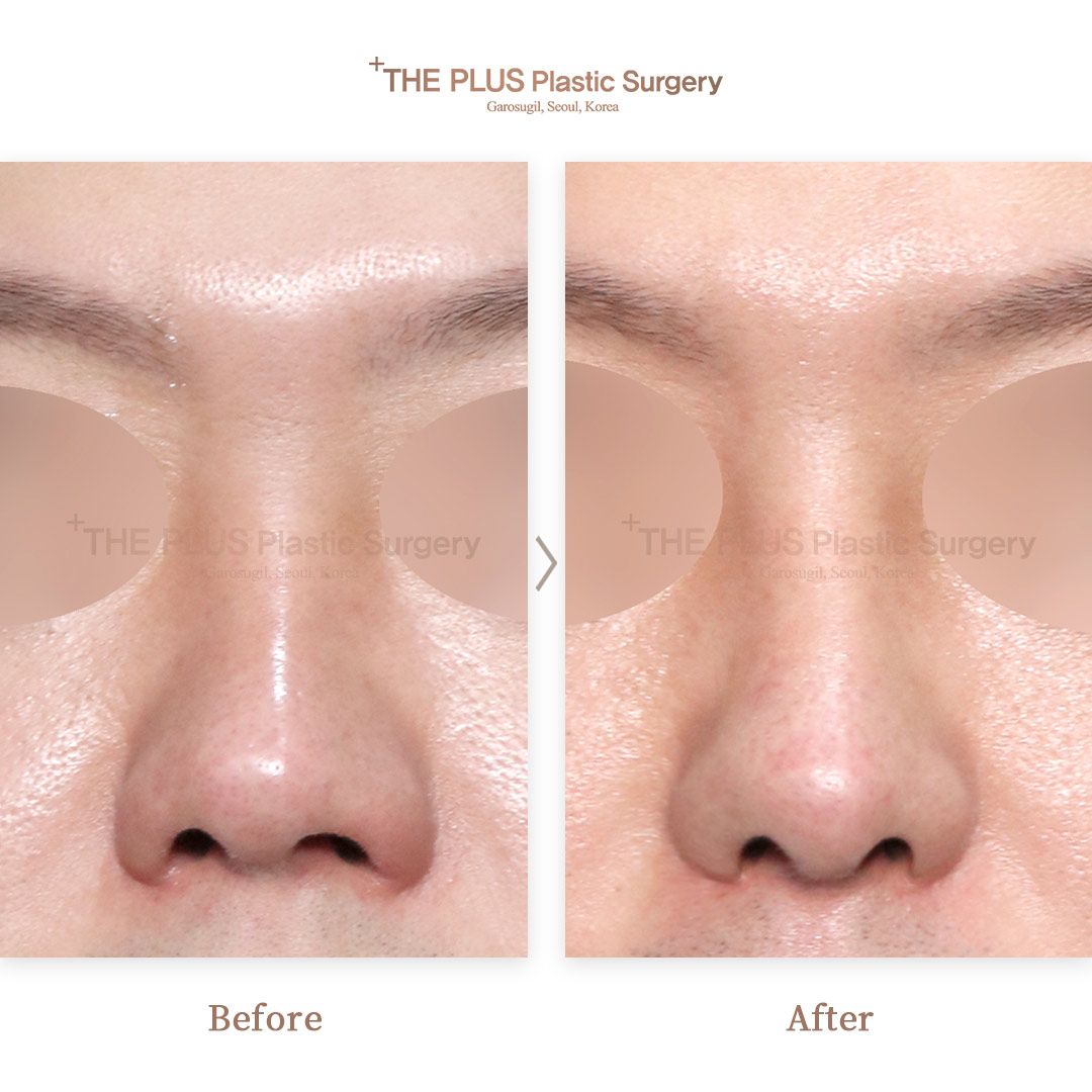 THE PLUS CLINIC KOREA -