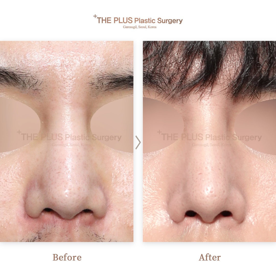 THE PLUS CLINIC KOREA -