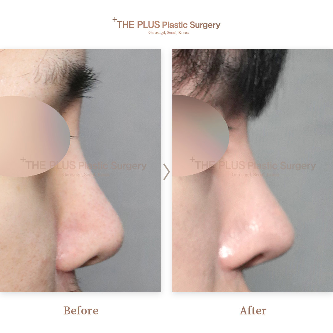 THE PLUS CLINIC KOREA -