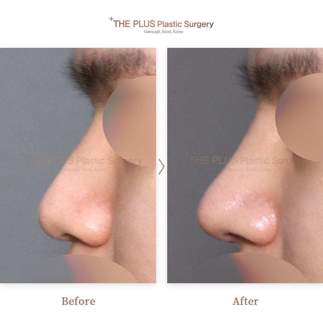 THE PLUS CLINIC KOREA -