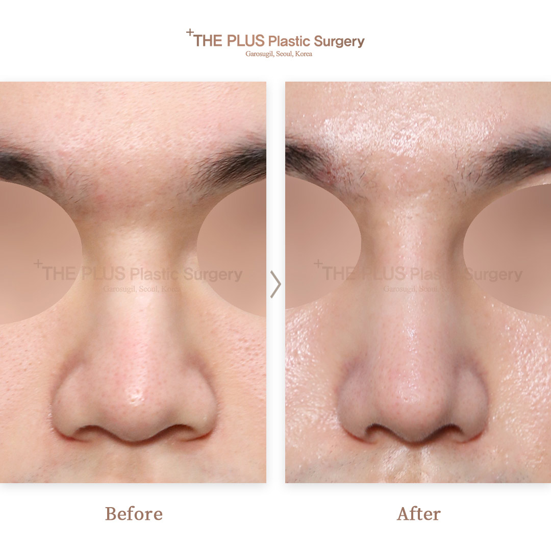 THE PLUS CLINIC KOREA -