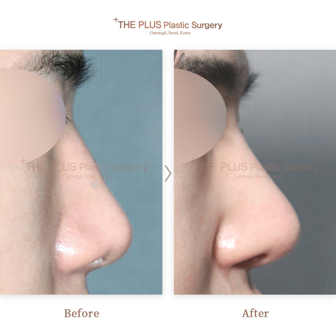 THE PLUS CLINIC KOREA -