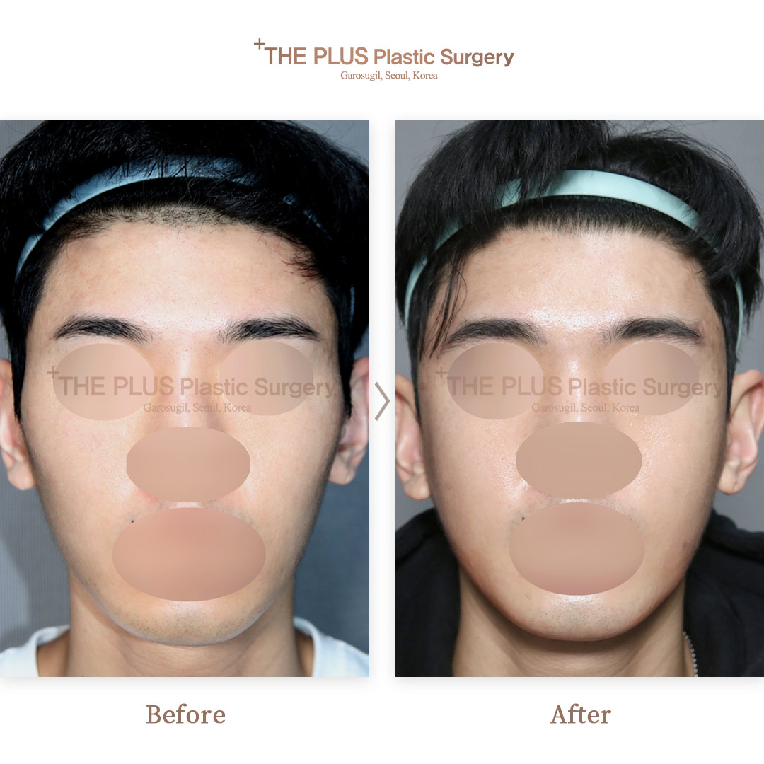 THE PLUS CLINIC KOREA -