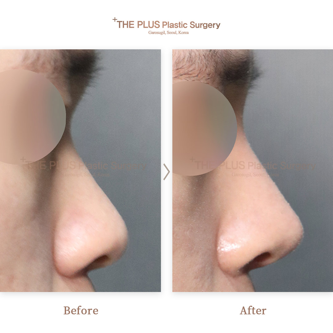 THE PLUS CLINIC KOREA -