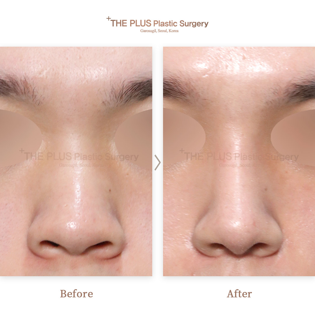 THE PLUS CLINIC KOREA -