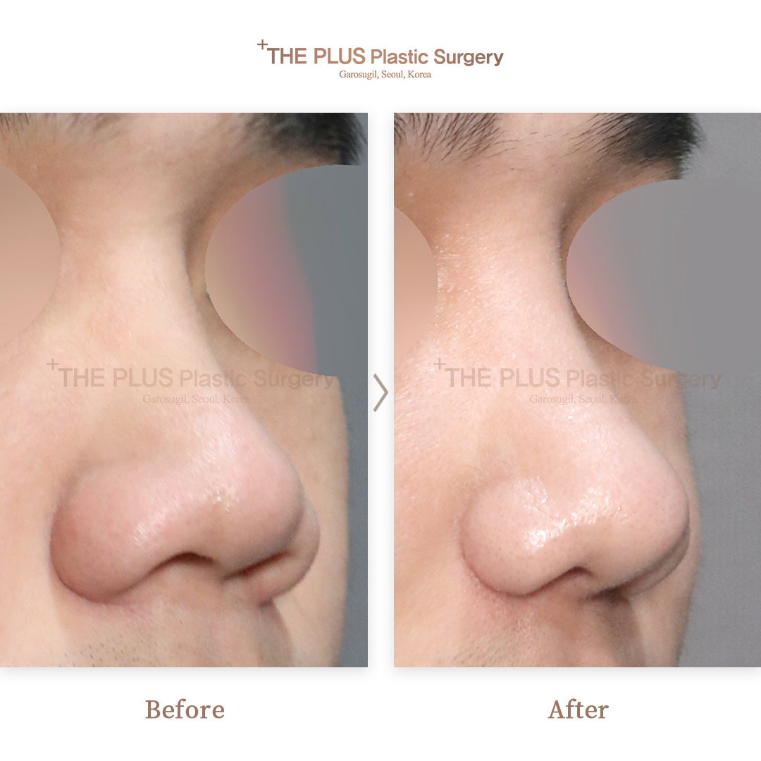 THE PLUS CLINIC KOREA -