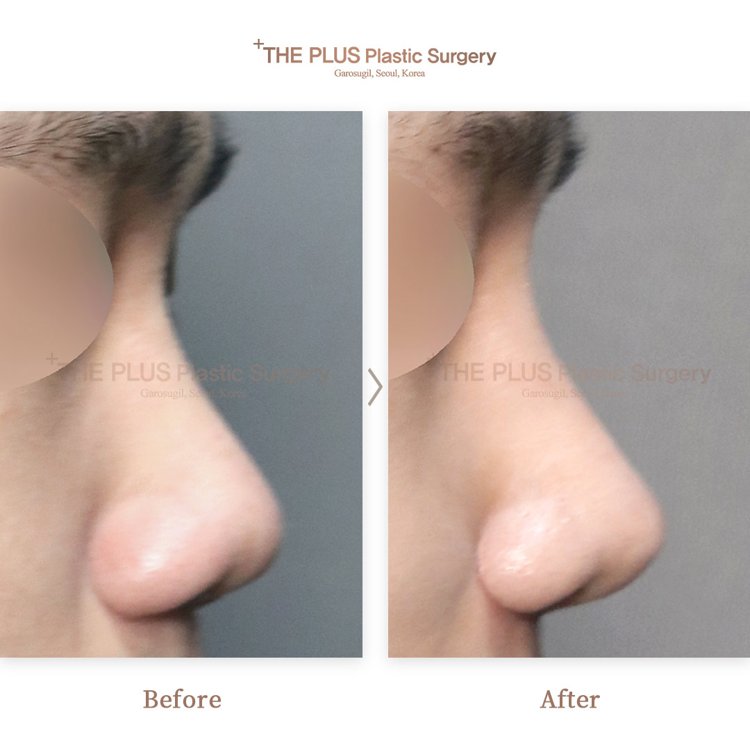 THE PLUS CLINIC KOREA -