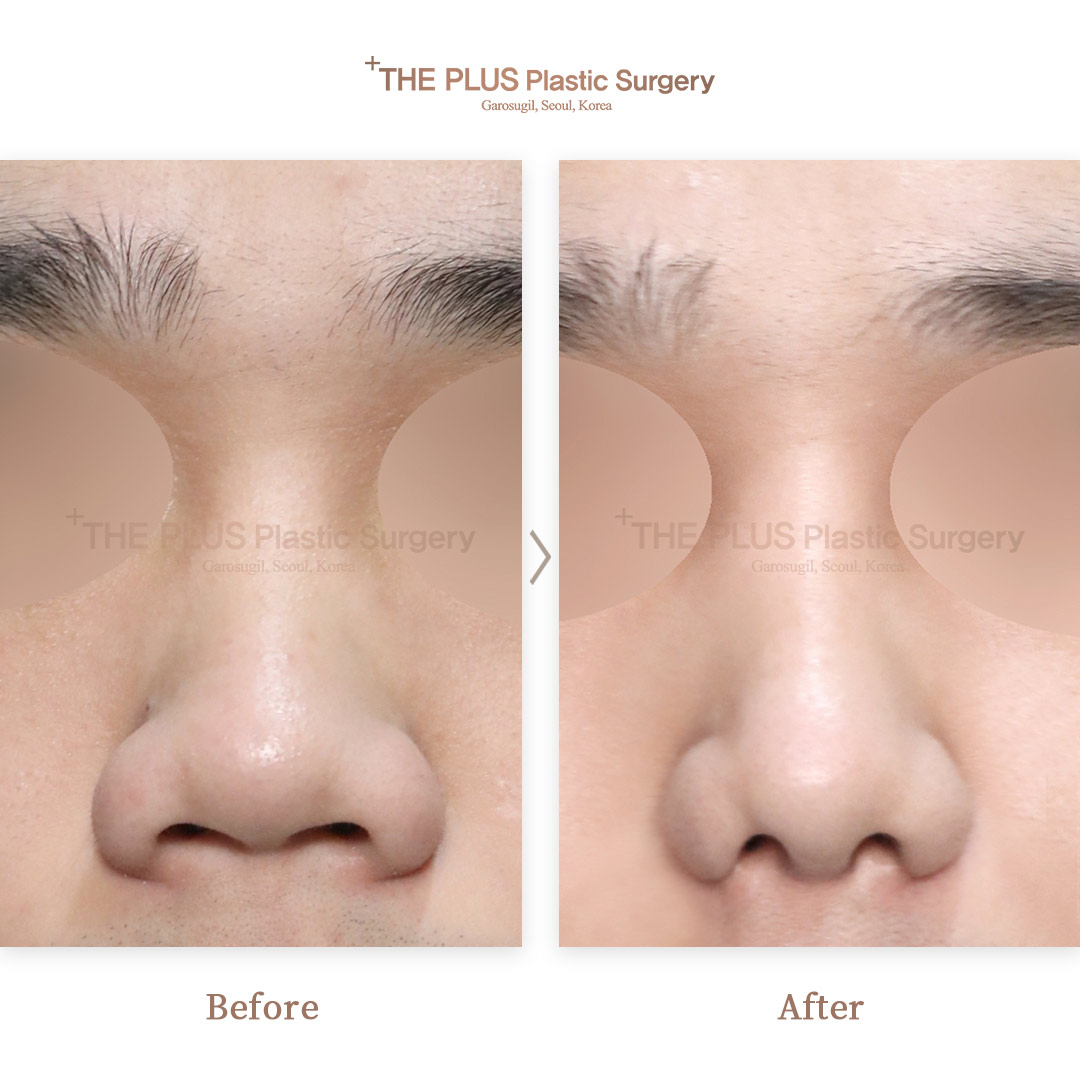 THE PLUS CLINIC KOREA -